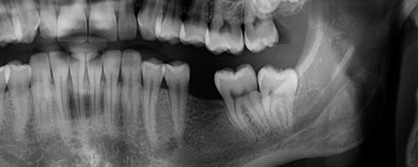 tooth John M Purdy DDS
